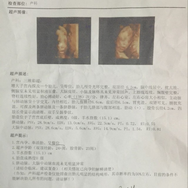 三维彩超