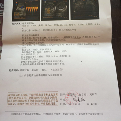 毛笔的正确执笔姿势是怎样的?
