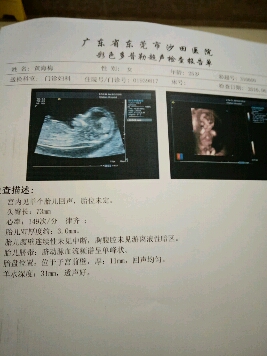 育儿问答 怀孕期 今天做了nt,nt值有点高呢怕怕,求安慰.