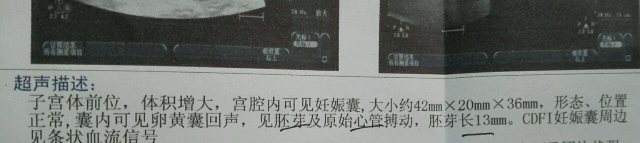 怀孕七周，感恩，祝福