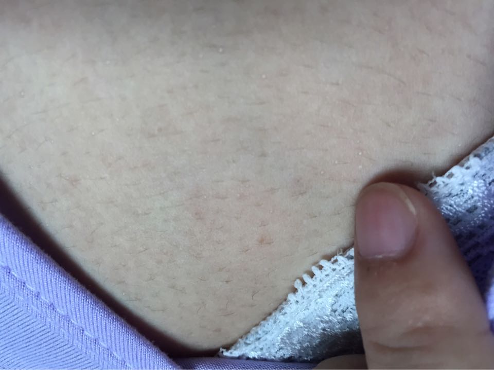 宝妈们帮我看看这是什么情况