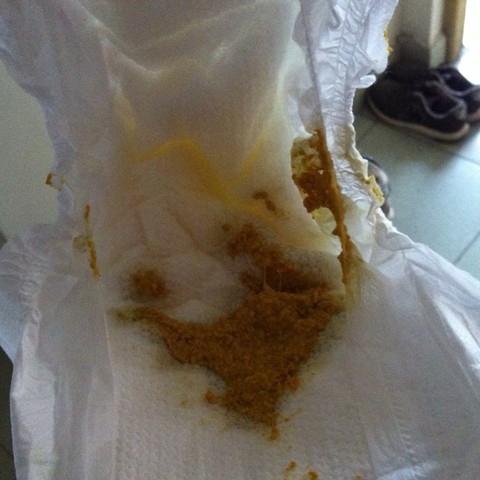 问答 幼儿期1-3岁 医生在线 专家问答 母乳餵养 婴儿辅食 产后护理