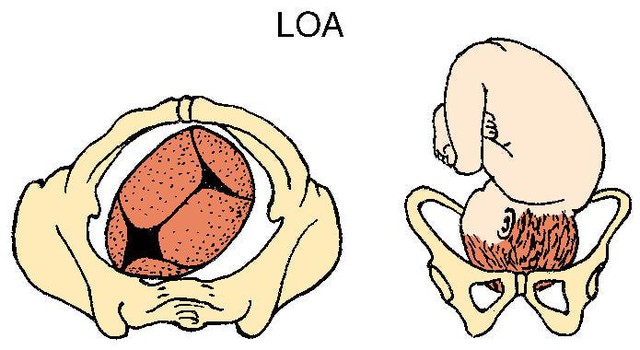 b超单上写的:loa lot lop roa rot rop是什麼意思?