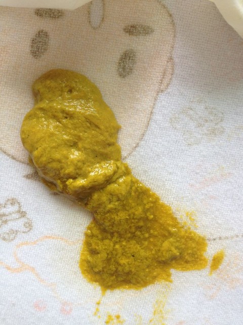 宝宝肠炎吃药之后停了,便便是这样的,可以吗?宝妈们帮我看看!