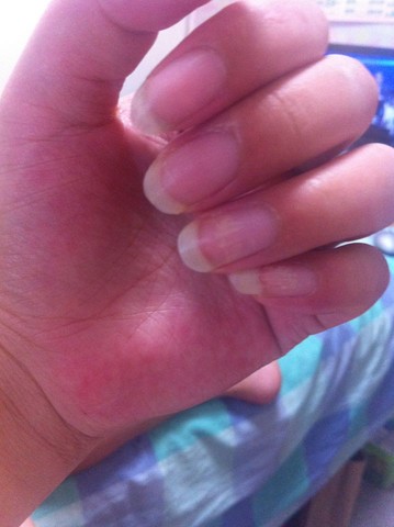 有木有怀孕后手指半月痕消失了的宝妈?