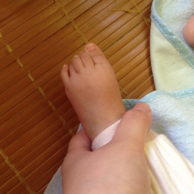 唐氏宝宝的脚丫子图片图片