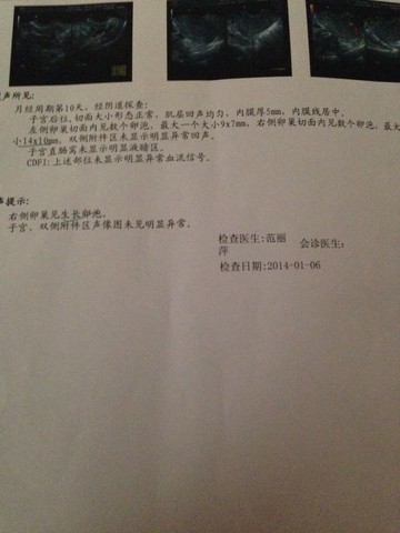 journal_insert_pic_122259698