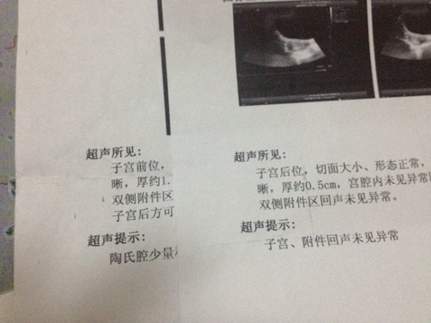 journal_insert_pic_122522542