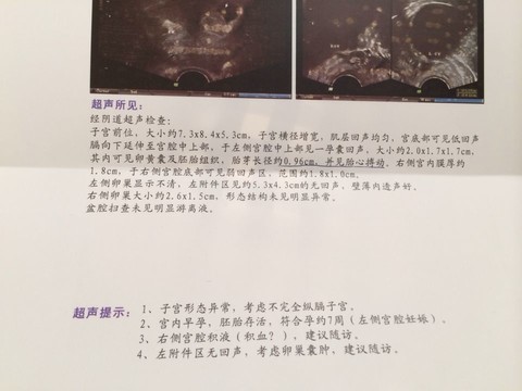 journal_insert_pic_123509178