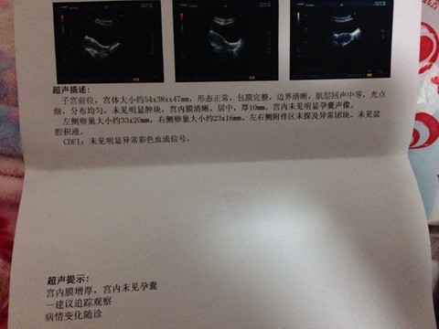 journal_insert_pic_124224403