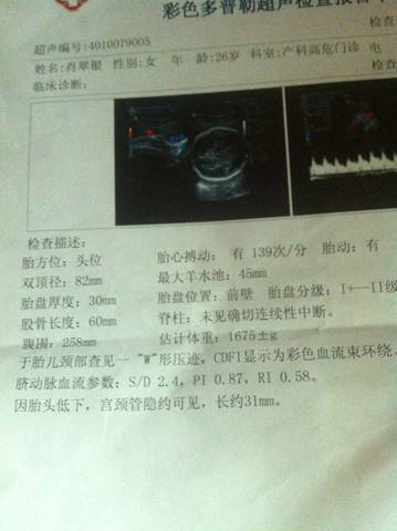 journal_insert_pic_124585064