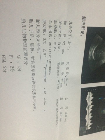 journal_insert_pic_125627291
