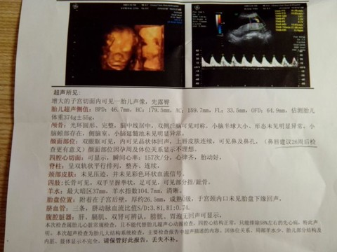 journal_insert_pic_125978935