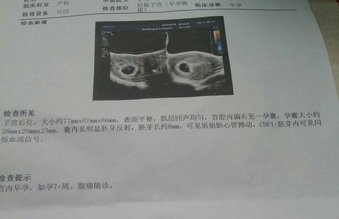 journal_insert_pic_125906447