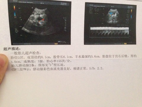 journal_insert_pic_125921084