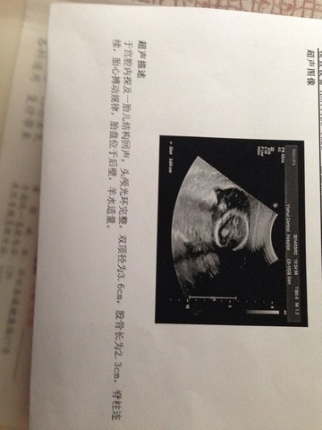 journal_insert_pic_127409849