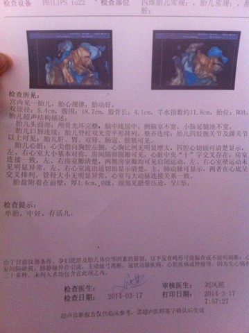journal_insert_pic_129232427