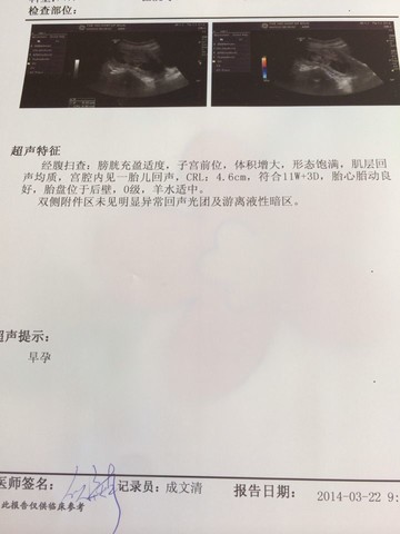 journal_insert_pic_129875636