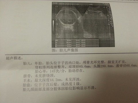 journal_insert_pic_130060132