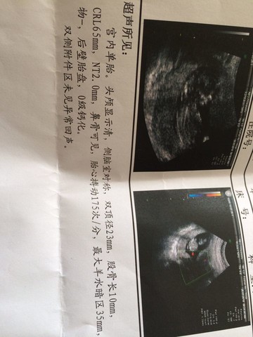 journal_insert_pic_130377913