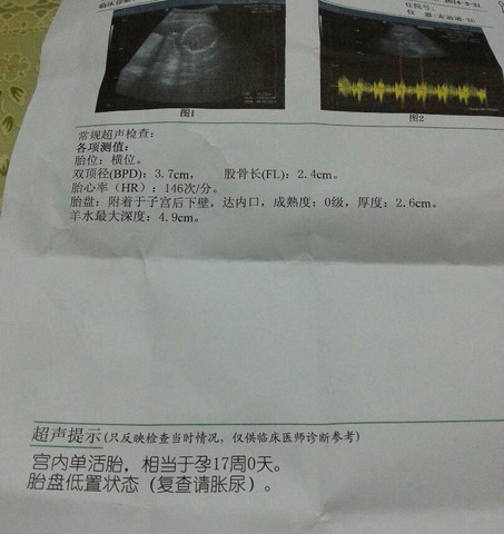 journal_insert_pic_131019358
