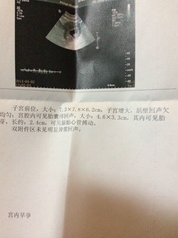 journal_insert_pic_131367934