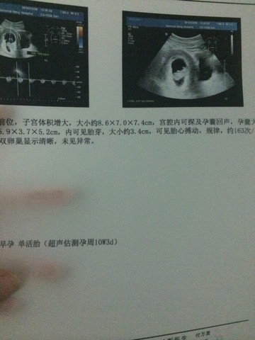 journal_insert_pic_131402832