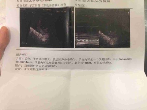 journal_insert_pic_131686329