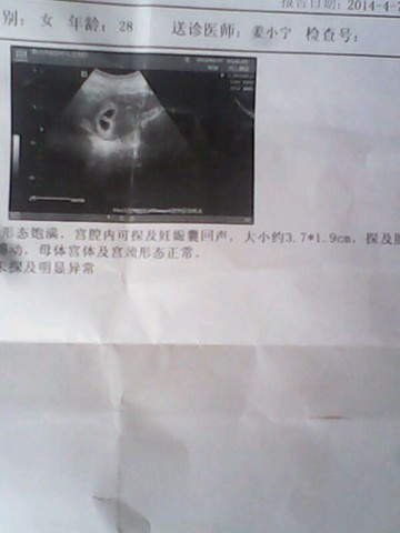 journal_insert_pic_131954911