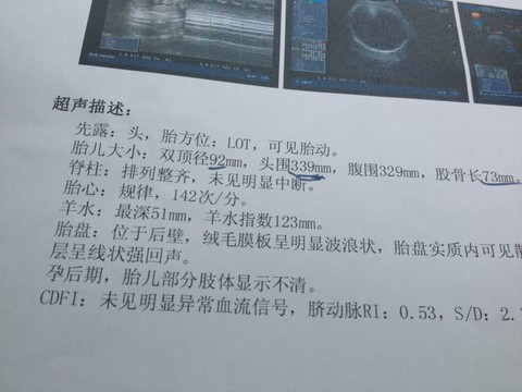 journal_insert_pic_132044989
