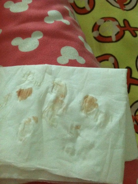 孕妈们现在都有分泌初乳了吧,是什么颜色呢?