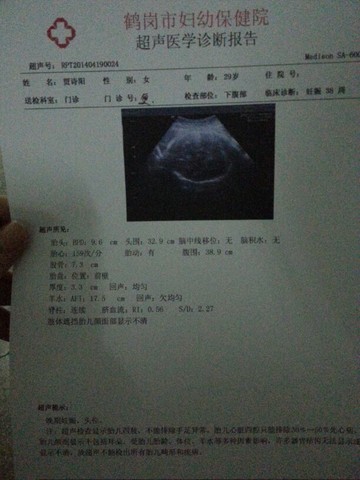 journal_insert_pic_133574452