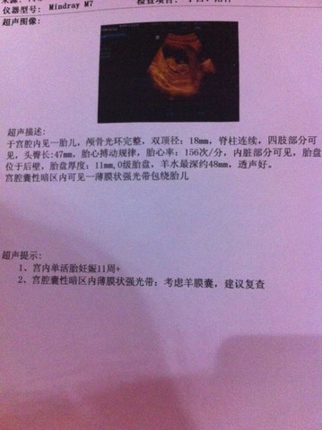 journal_insert_pic_134733093