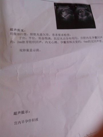 journal_insert_pic_135209213