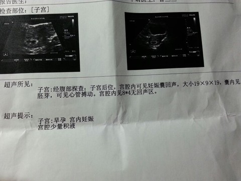 journal_insert_pic_135420228