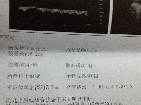journal_insert_pic_136677904