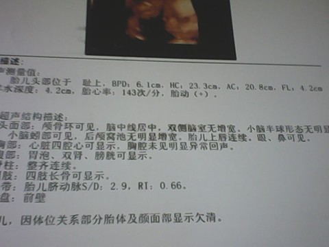 journal_insert_pic_136916651