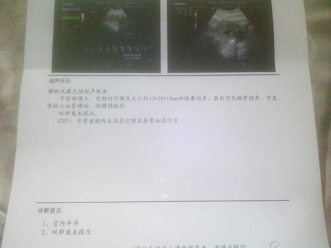 journal_insert_pic_138403916
