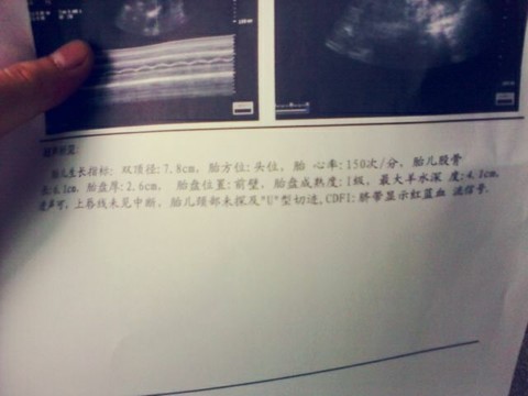 journal_insert_pic_139927085