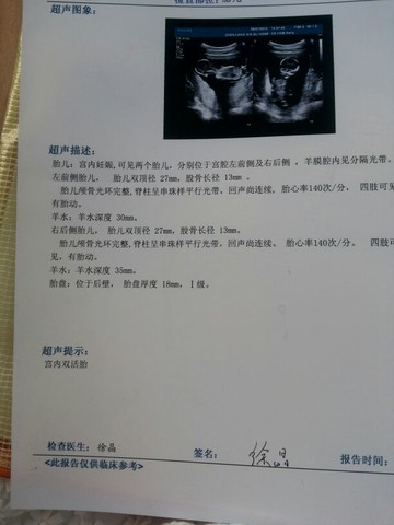 journal_insert_pic_140313574