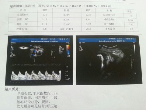 journal_insert_pic_140608193