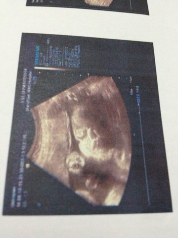journal_insert_pic_140627018