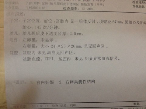journal_insert_pic_140779277
