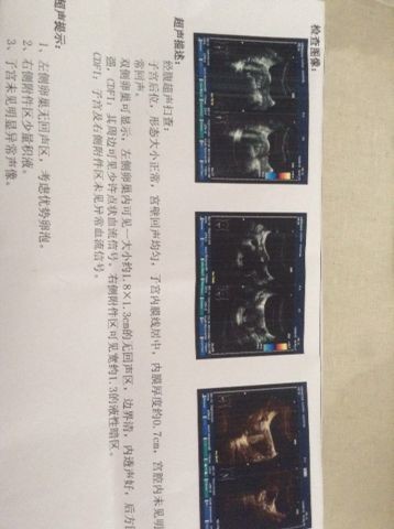 journal_insert_pic_141498720