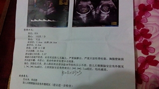 journal_insert_pic_142453150