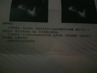 journal_insert_pic_142692428