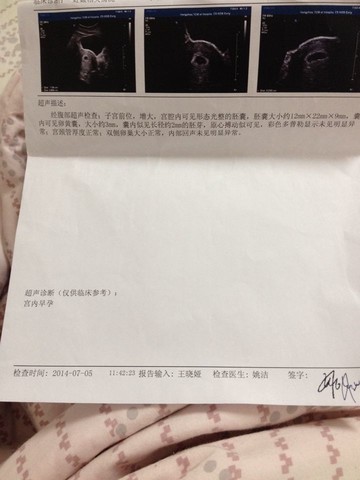 journal_insert_pic_143445504