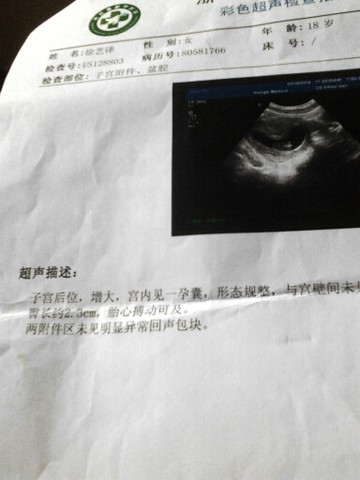 journal_insert_pic_144036023