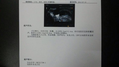 journal_insert_pic_144660950