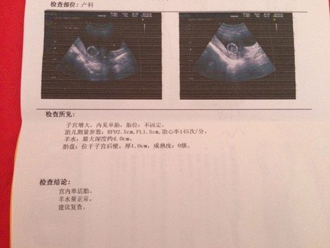 journal_insert_pic_145139047